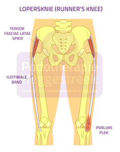 https://www.podotherapiereggestreek.info/wp-content/uploads/2019/01/lopersknie-runners-knee-podotherapie-reggestreek-rijssen.png