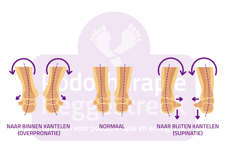 Stand Voet Normaal Valgisatie Varisatie Podotherapie Reggestreek Rijssen Stand Voet Normaal Valgisatie Varisatie Podotherapie Reggestreek Rijssen