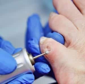 Instrumentele Behandeling Podotherapie Reggestreek Rijssen Instrumentele Behandeling Podotherapie Reggestreek Rijssen